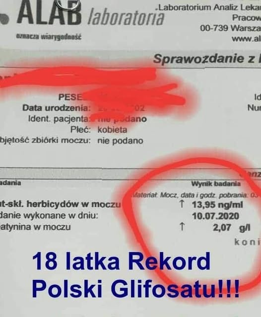 Glifosat w warzywach – dlaczego rośliny trują bardziej niż mięso?