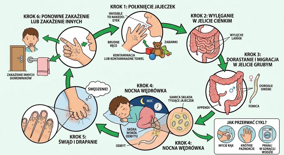 Owsik ludzki – jak wykryć i zwalczyć nieproszonego gościa?